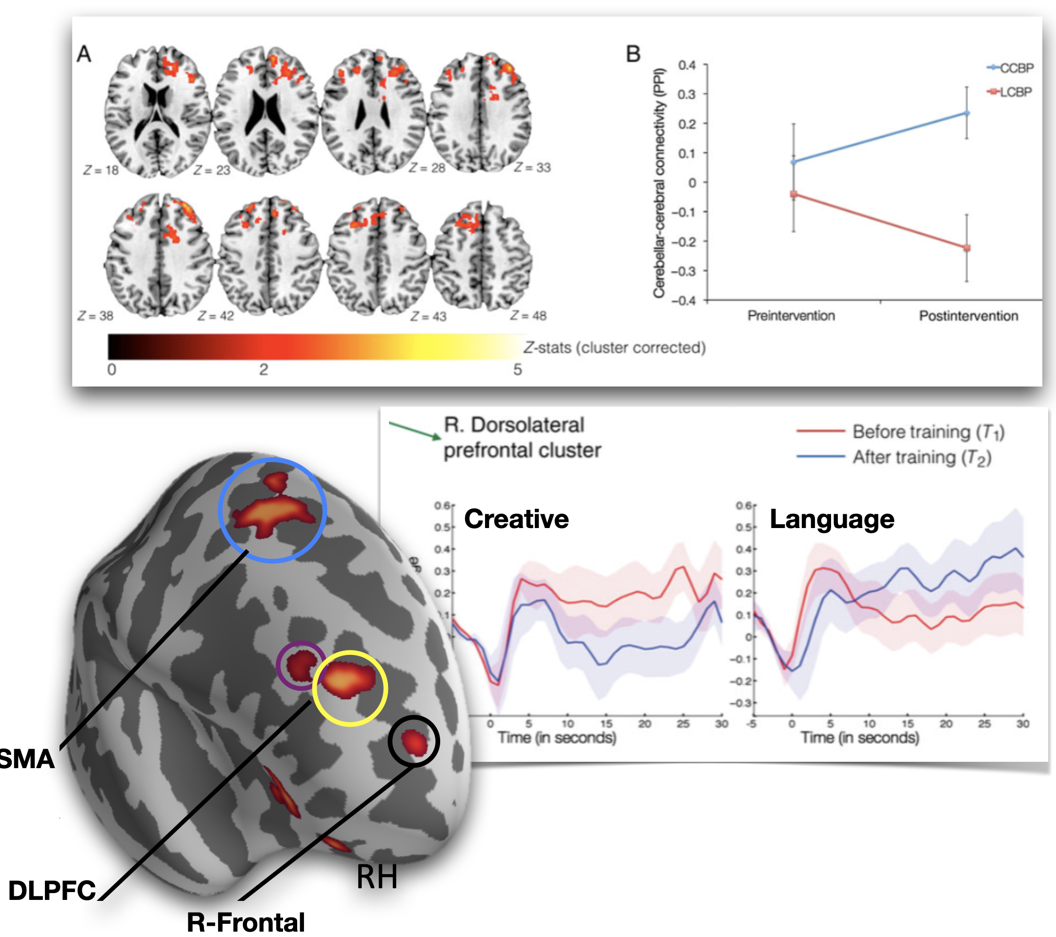 Examining the neural correlates of creative capacity enhancement using targetted training.