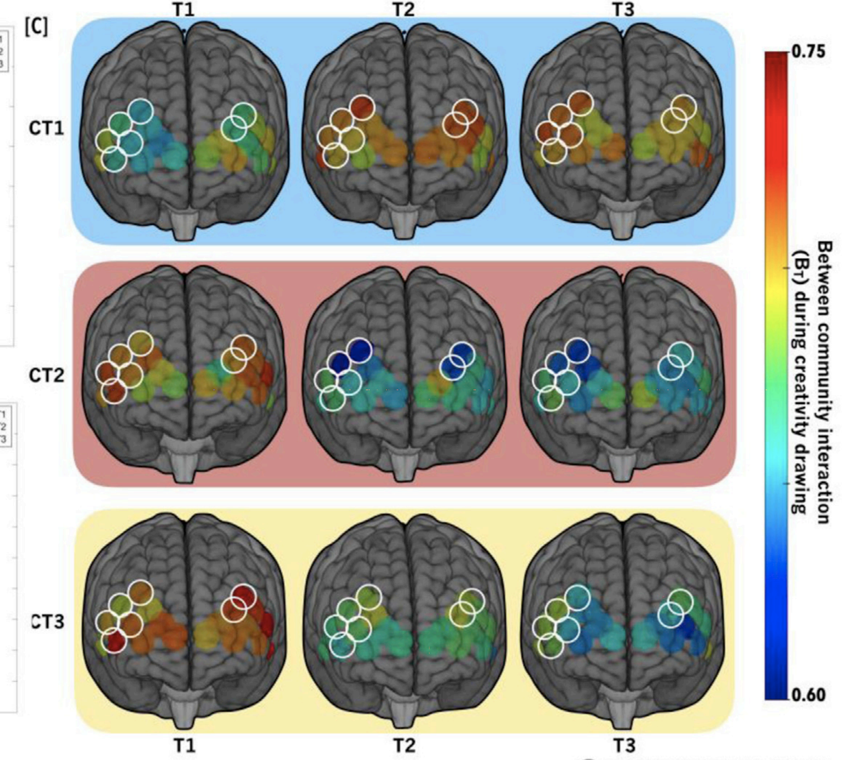 Creative brain development