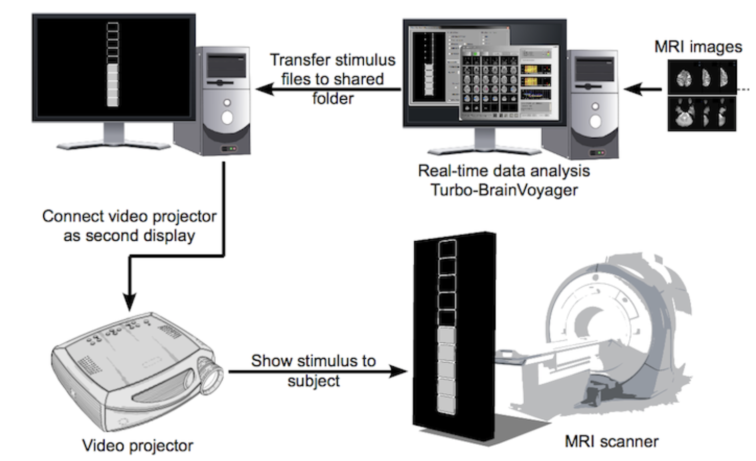 7T-MRI neurofeedback for treatment-resistant depression